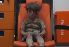Little boy in Aleppo a vivid reminder of war`s horror - VIDEO